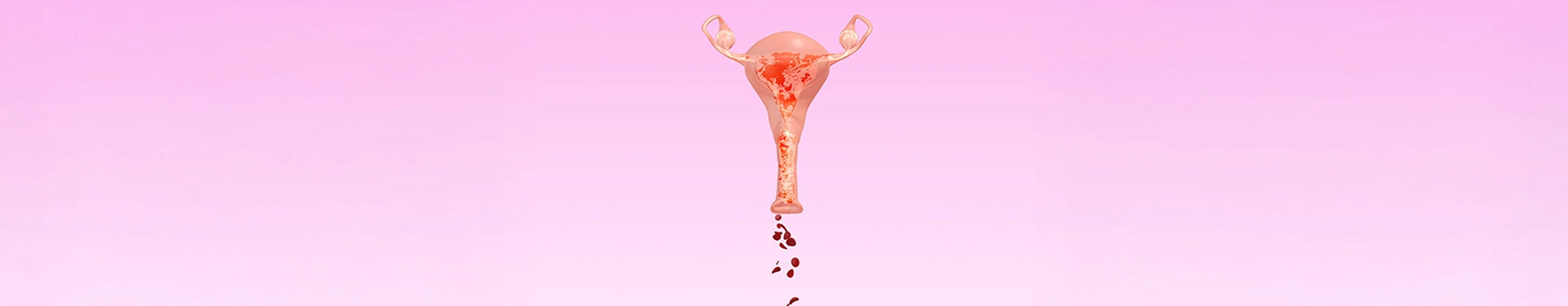 Metrorragia: ¿qué es y cuáles son sus causas? - Nosotras 