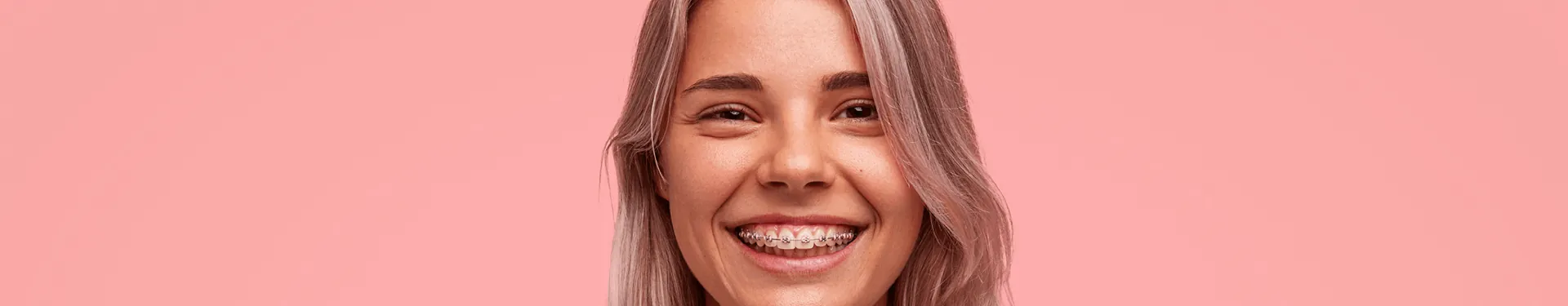 ¿Cómo dormir con brackets?