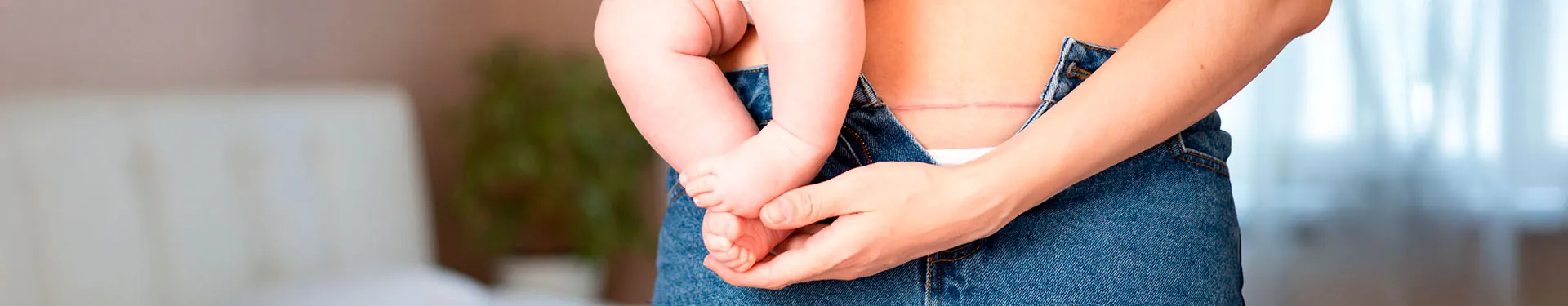 Recuperación de cesárea: tips para tu proceso